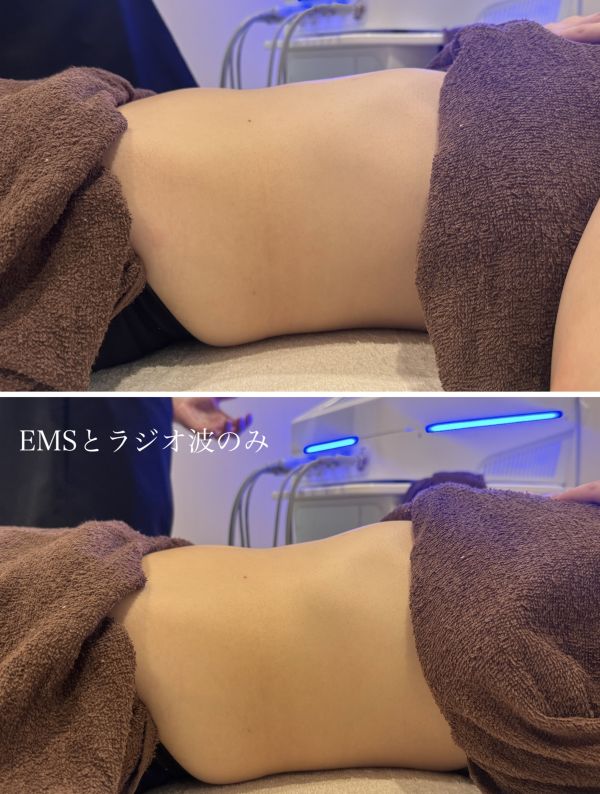 1回の施術。続けるほど定着！姿勢改善