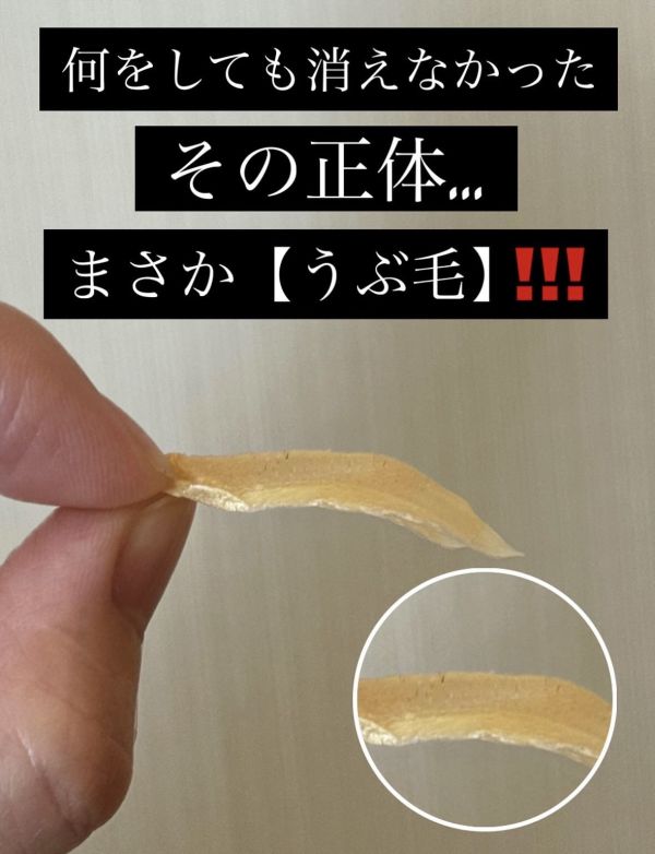 毛穴の種類によってケアは変わります！肌質改善