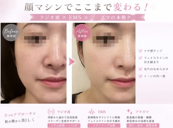 そのむくみ、たるみ…放置していませんか？ 痩身/池袋