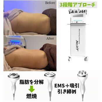 【お腹まわりのスッキリケア】池袋痩身