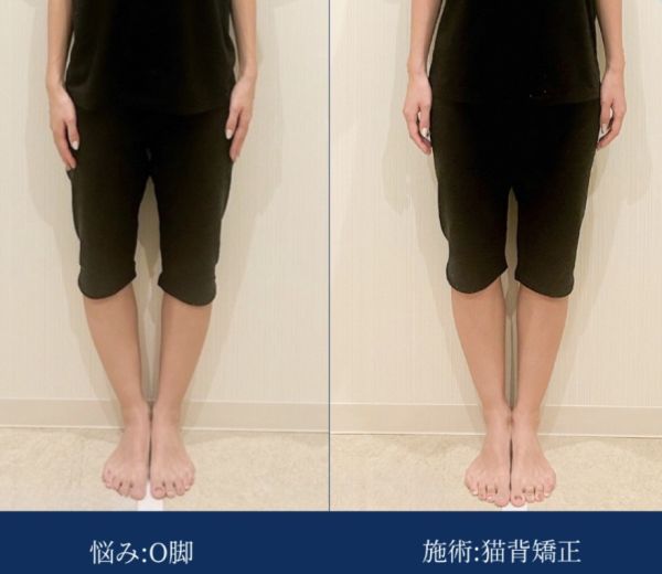 幅広く人気のある施術【ボディ】