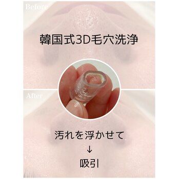 普通の毛穴洗浄とは違う！何が違うのか？池袋