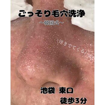池袋/黒ずみ  毛穴の黒ずみ＝汚れ！？