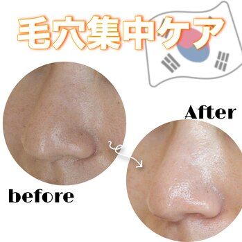 池袋フェイシャル/毛穴、ちゃんと掃除できてますか?
