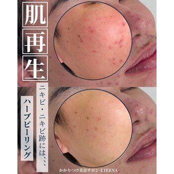肌は1枚の皮じゃない！実はそれぞれ役割が違うんです