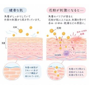 池袋フェイシャル/謎の肌荒れの原因は?