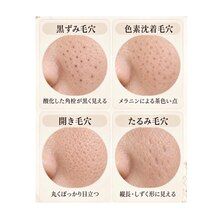 自分の毛穴の種類は？ 池袋